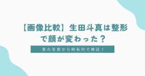 【画像比較】生田斗真は目の整形で顔が変わった？昔の写真から時系列で検証！