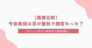 【画像比較】有村架純は整形で顔変わった？エラボトックスの噂についても徹底調査！
