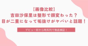 【画像比較】吉田沙保里は整形で顔変わった？目が二重になって垢抜けがヤバいと話題！