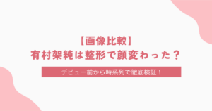 【画像比較】有村架純は整形で顔変わった？エラボトックスの噂についても徹底調査！